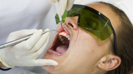 Zahnarzt behandelt Zähne mit dem Laser